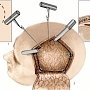 В Крыму трепанацию черепа перестанут делать «на глазок»